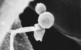 従来フィルタに捕集されたカビ胞子と発芽する菌糸