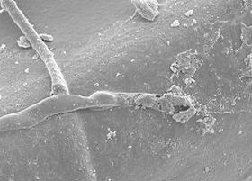 酵素フィルタにより溶解されたカビ菌糸
